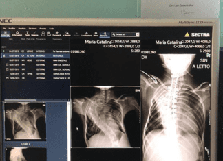 Maria-Cătălina, mica minune din România, primul caz ajutat de Fundaţia Cuviosul Gherontie de la Tismana