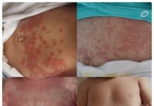 Dragostea Cuviosului se arată în vindecări